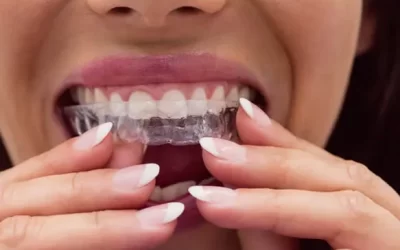 Invisalign New Orleans: Clear Aligner Therapy for Discreet Orthodontic Correction